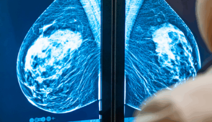 AI Is Already Helping Doctors Spot Breast Cancer Earlier — and Save Lives - ctrlf5